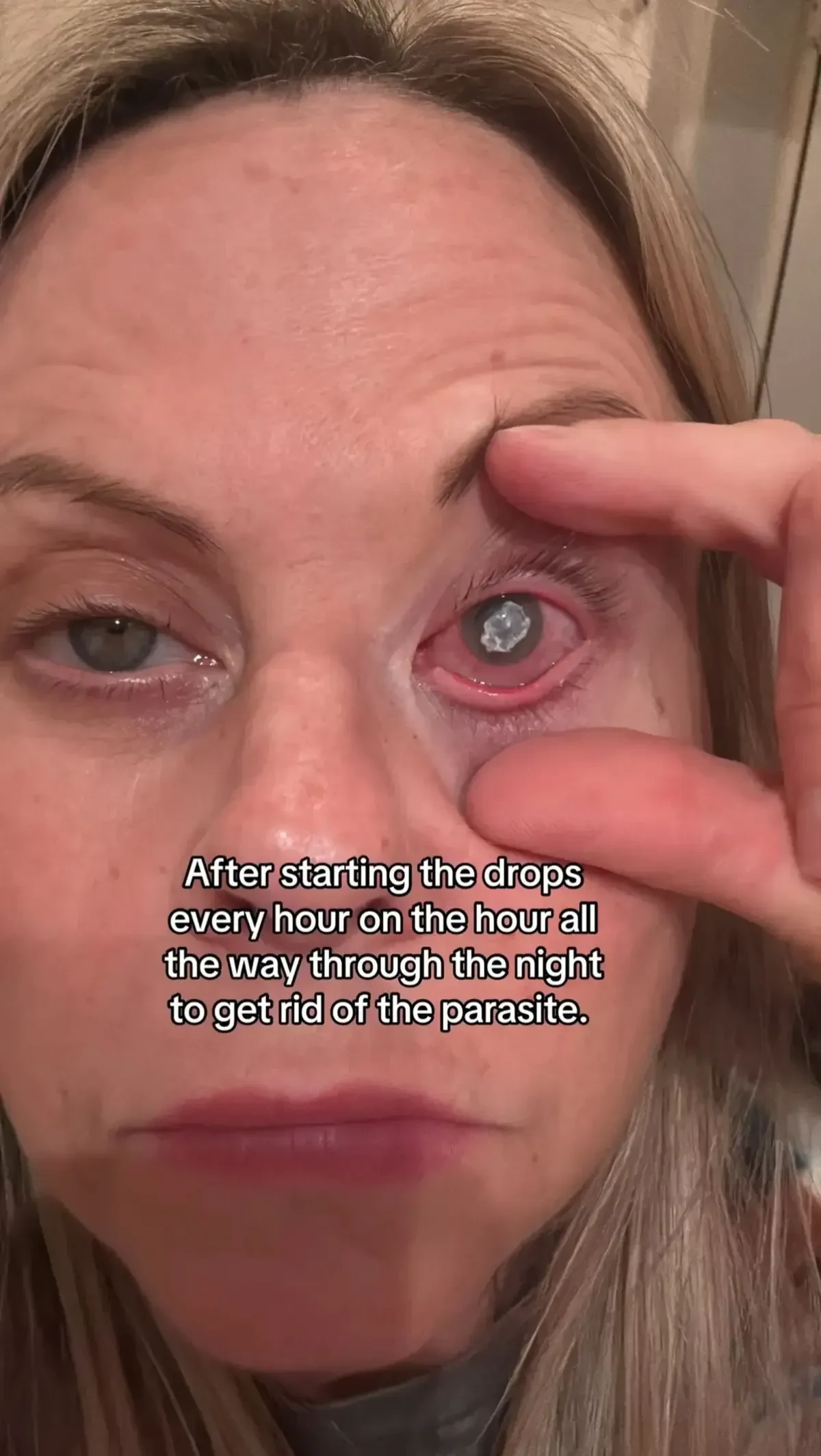 Washing face contact lenses emma 134770167
