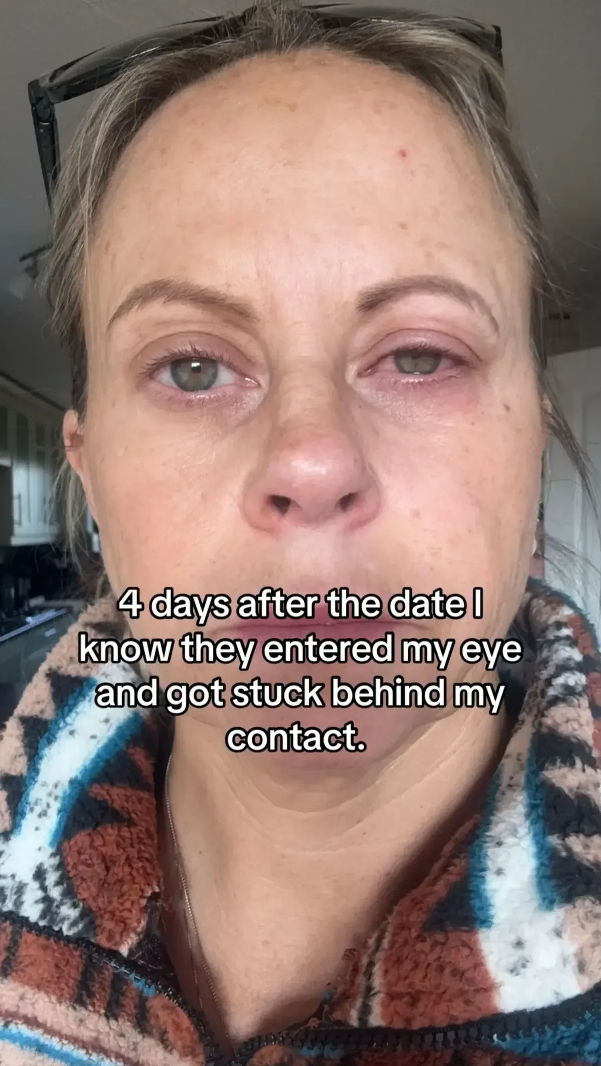 Washing face contact lenses emma 134770162