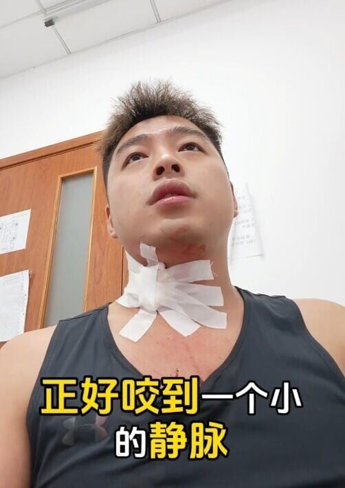 醫生為熊先生處理傷口後,叮囑持續按壓止血,並建議留院觀察2、3個小時。(微博)