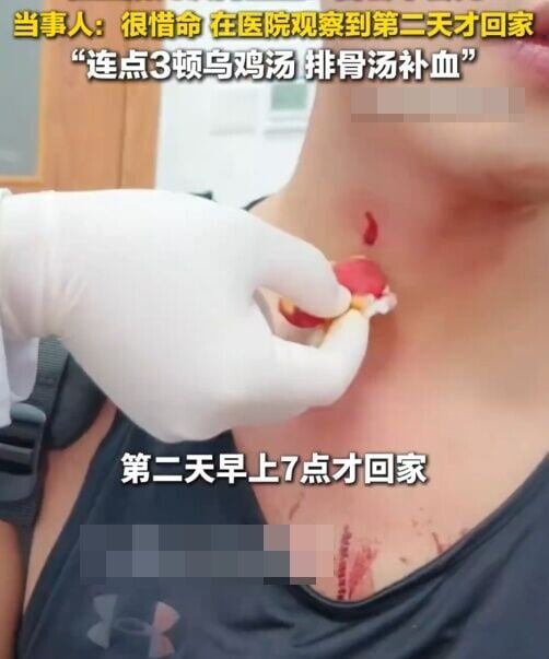 經醫生檢查,懷疑蚊子叮咬部位恰好位於靜脈血管,抓撓導致毛細血管破裂。(微博)