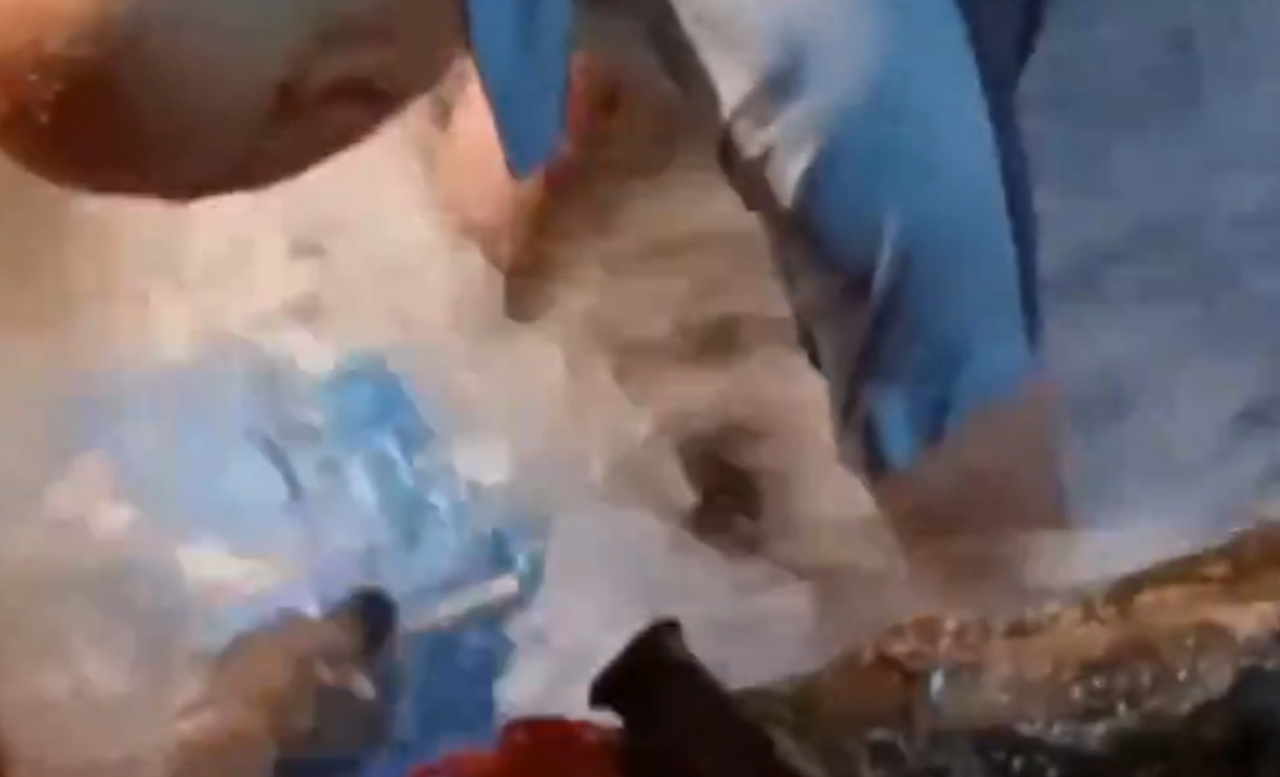筲箕灣道新成街交界一條18吋食水管道破裂,網上流傳一段短片,疑拍攝到工程人員在爆水管位置搶修的情況(影片截圖)