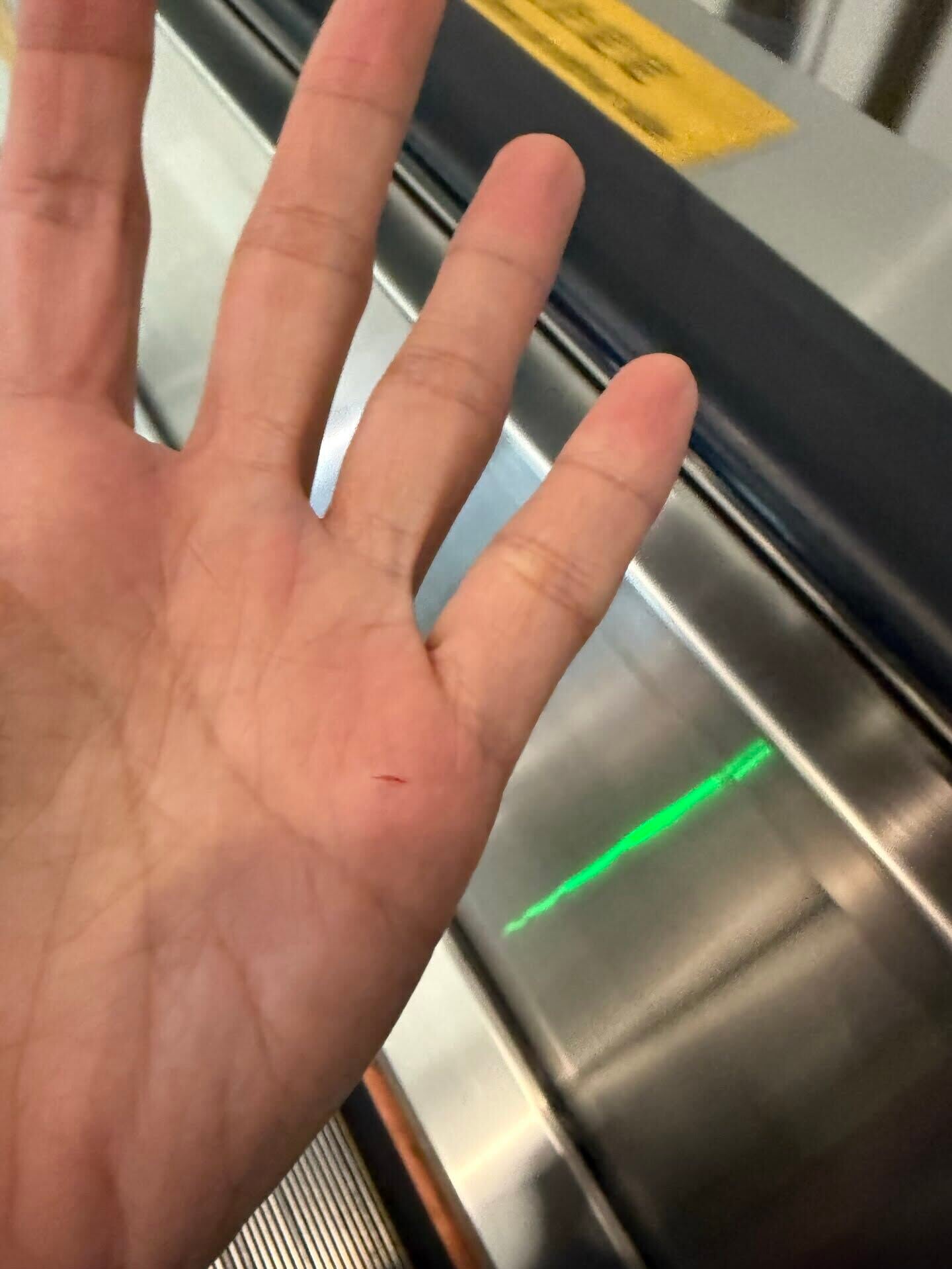 港鐵金鐘站扶手電梯有針狀尖銳物,一名乘客被割傷(Threads)