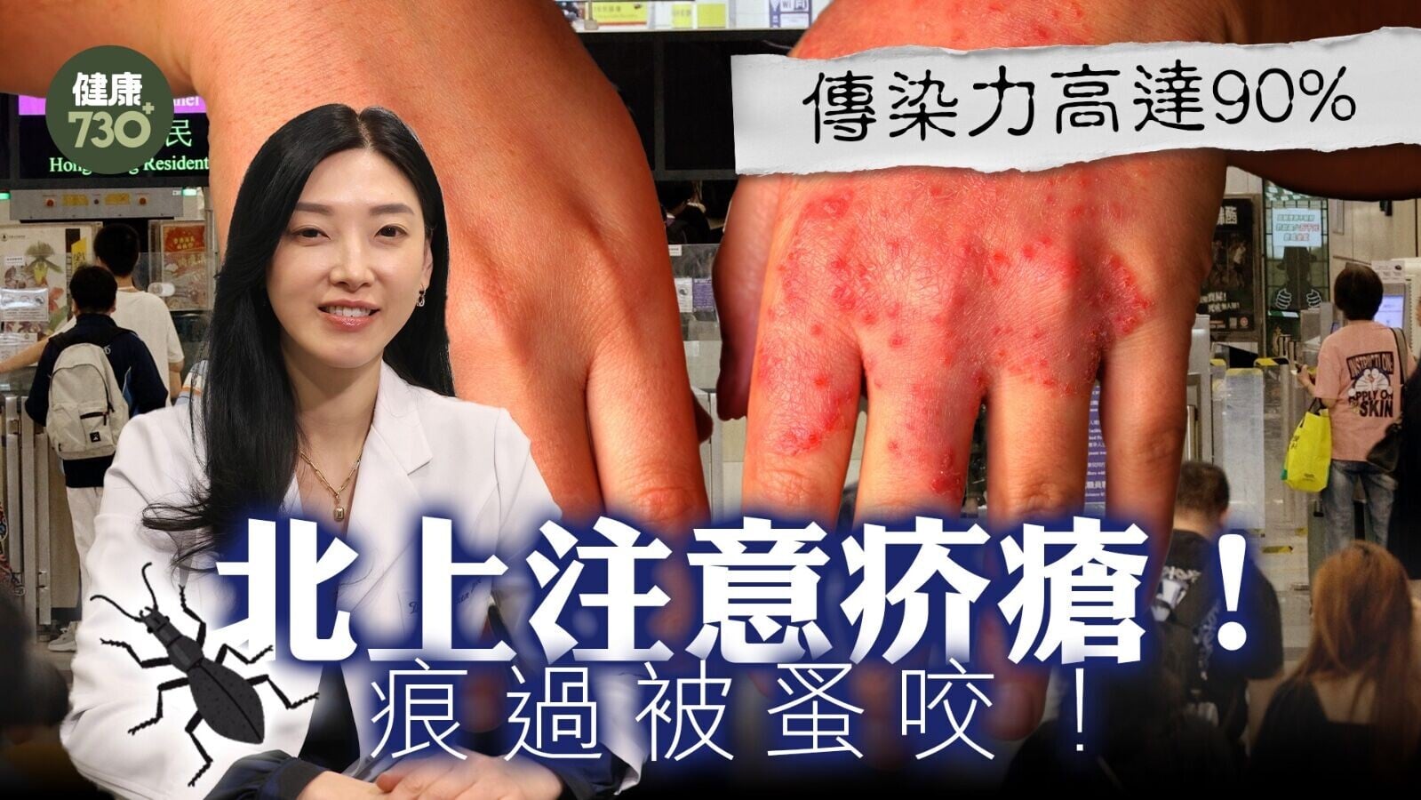深圳疑爆發疥瘡與手足口病！皮膚科醫生拆解4大皮膚病症狀與預防攻略