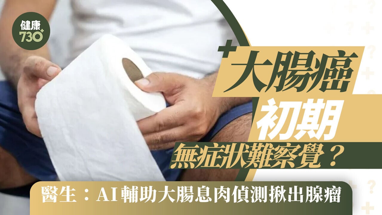 大腸癌初期無症狀難察覺？醫生：AI輔助大腸息肉偵測揪出腺瘤