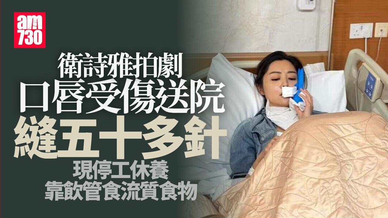 衛詩雅縫逾50針後報平安 僅靠飲管進食拍《破‧地獄》曾險傷面部