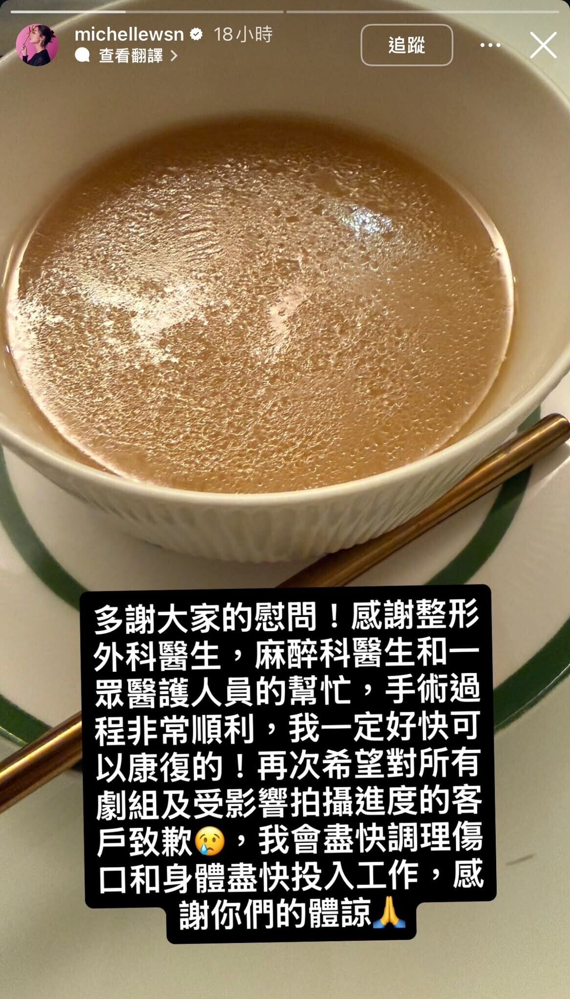 956eb4a5 829f 4c17 9947 d8b3223d357a