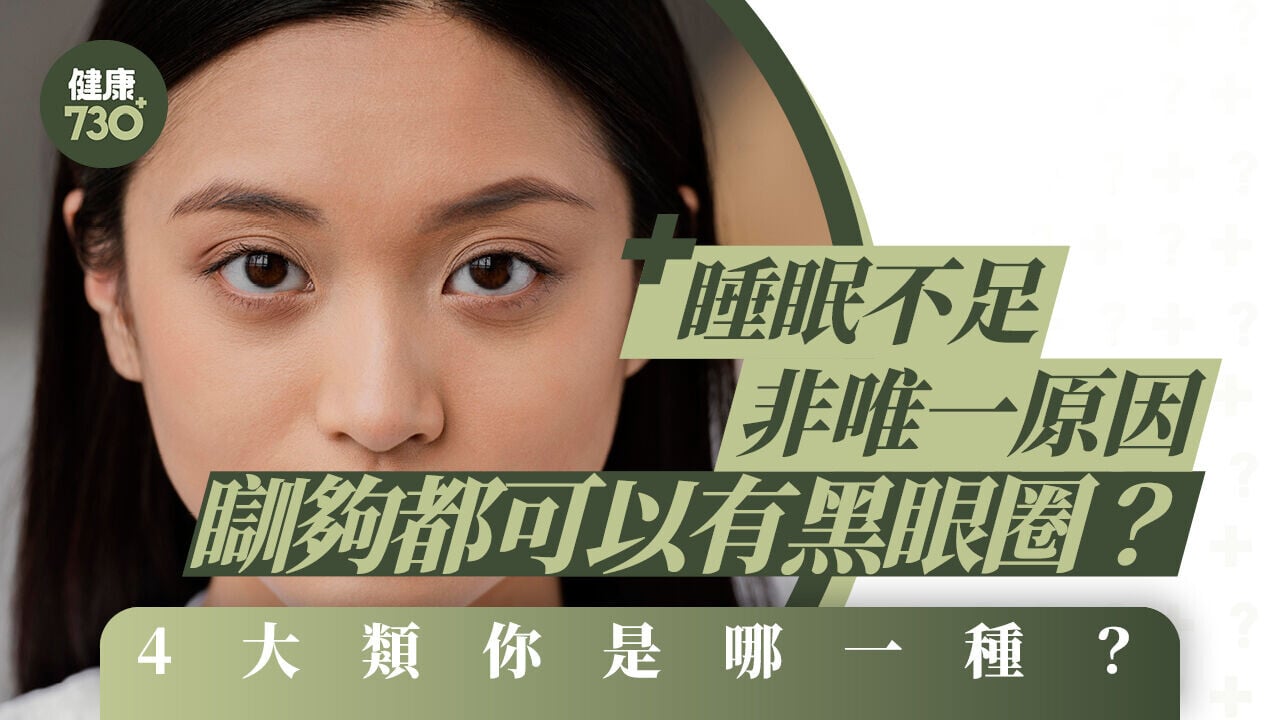 黑眼圈消除｜睡眠不足非唯一原因 瞓夠都可以有黑眼圈？4大類你是哪一種？