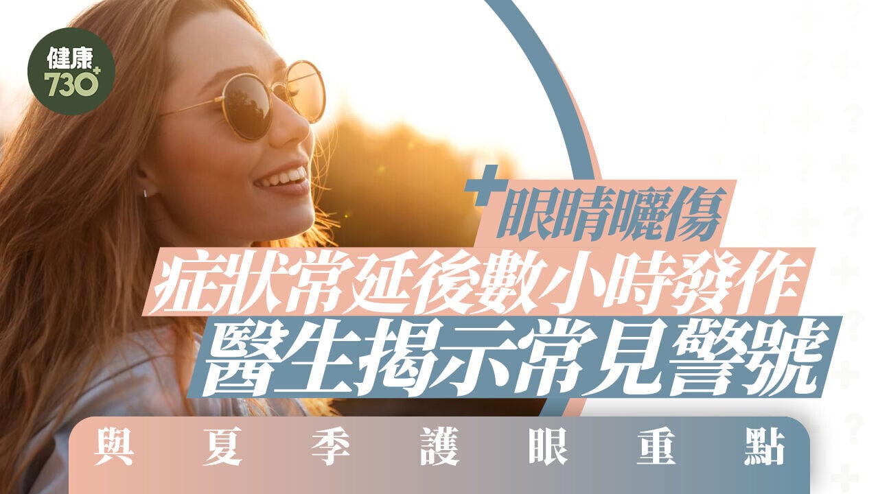 「眼睛曬傷」症狀常延後數小時發作 醫生揭示常見警號與夏季護眼重點