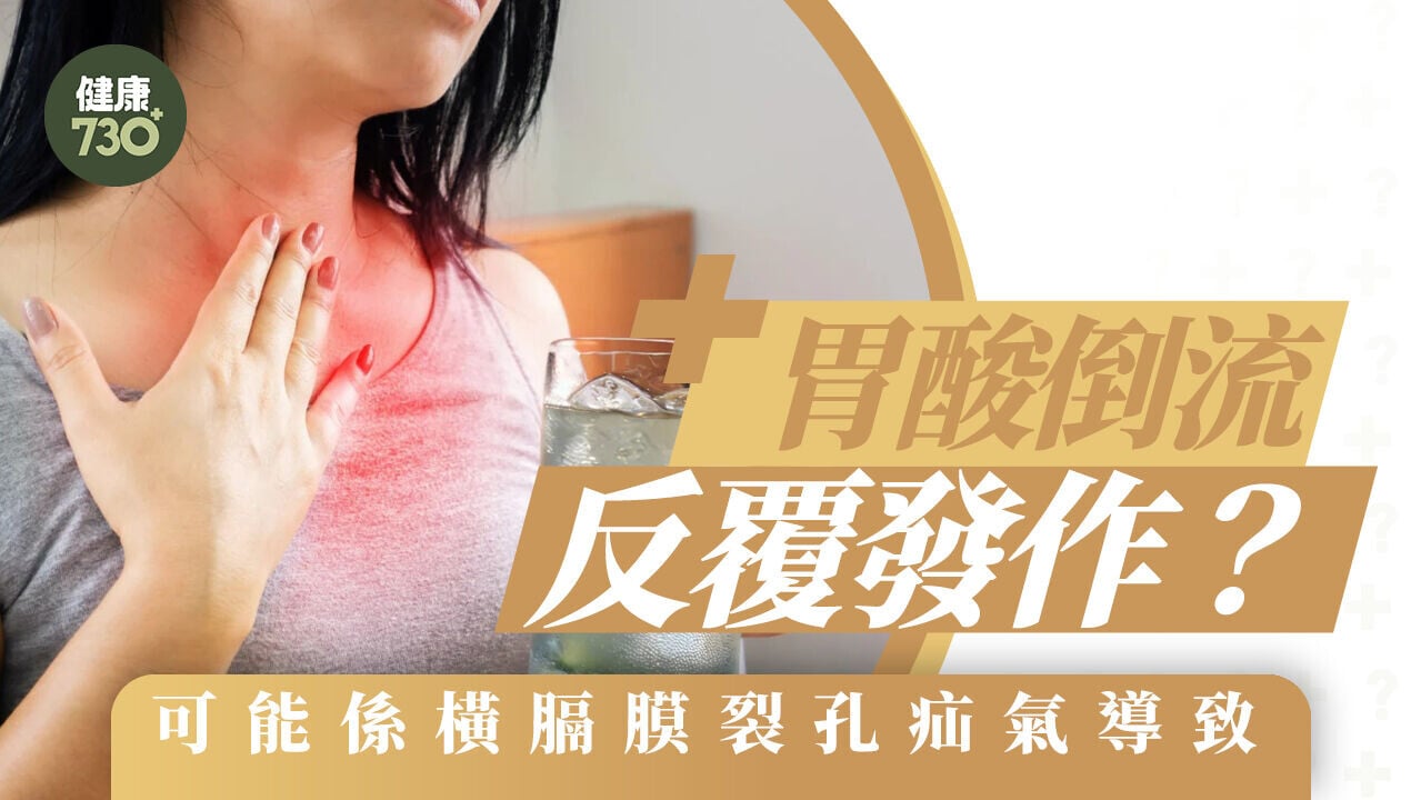 胃酸倒流反覆發作？可能係橫膈膜裂孔疝氣導致