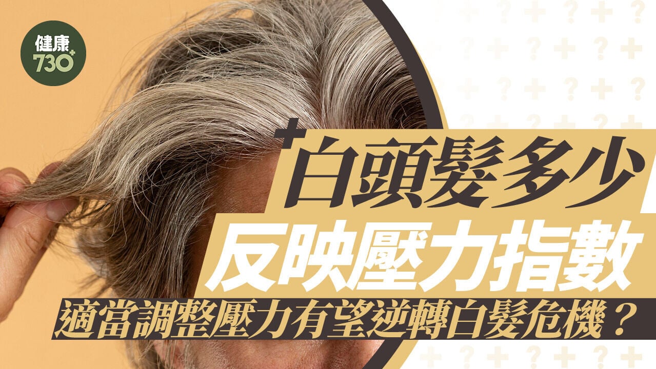 白頭髮｜白頭髮多少反映壓力指數 適當調整壓力有望逆轉白髮危機？
