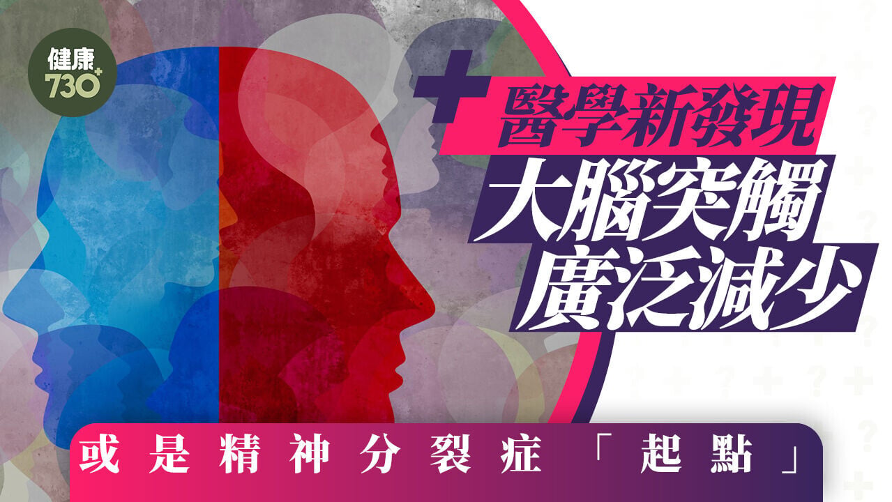 醫學新發現 大腦突觸廣泛減少 或是精神分裂症「起點」