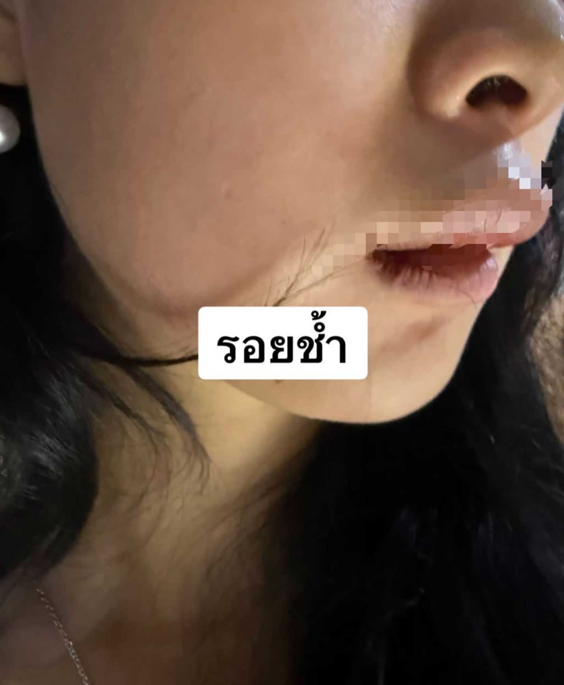 一名中國女子在泰國曼谷遭4名泰國男子綁架準備送往達府湄索縣,懷疑將她轉運至緬甸,女子期間遇上警方路障跳車自救。(網上圖片)