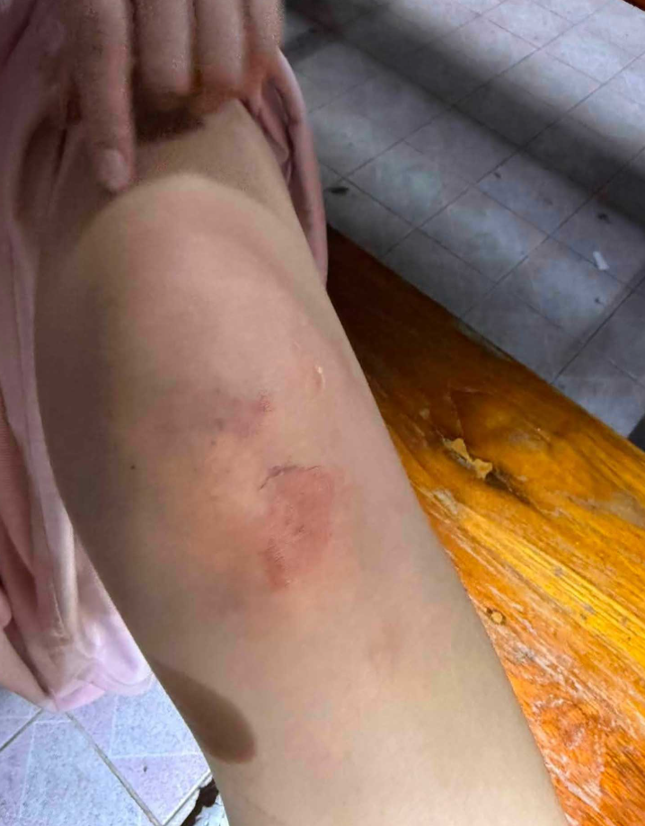 一名中國女子在泰國曼谷遭4名泰國男子綁架準備送往達府湄索縣,懷疑將她轉運至緬甸,女子期間遇上警方路障跳車自救。(網上圖片)