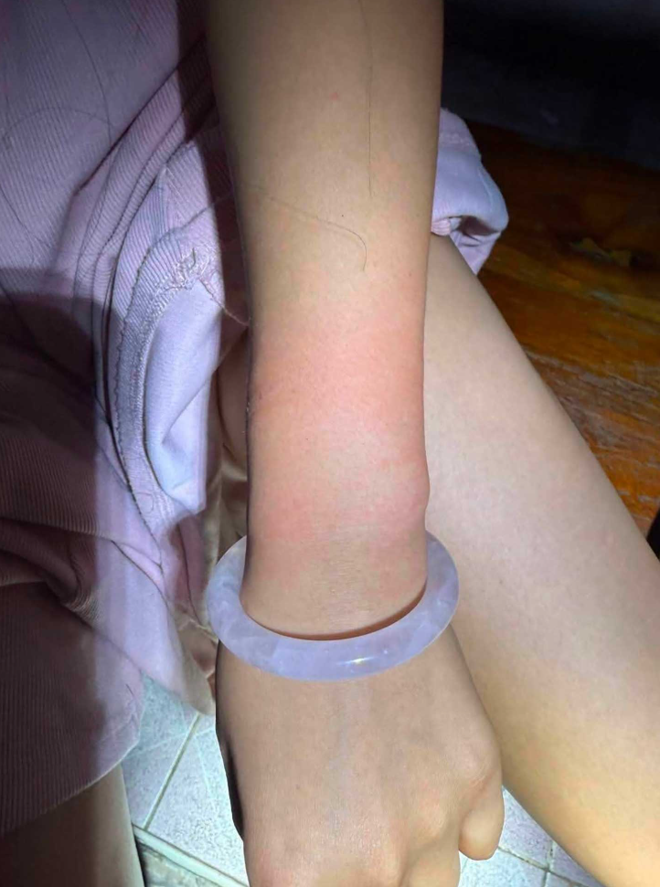 一名中國女子在泰國曼谷遭4名泰國男子綁架準備送往達府湄索縣,懷疑將她轉運至緬甸,女子期間遇上警方路障跳車自救。(網上圖片)