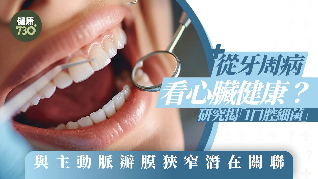 從牙周病看心臟健康？研究揭「1口腔細菌」與主動脈瓣膜狹窄潛在關聯