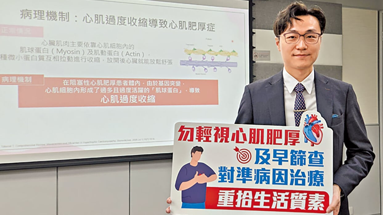 黃曜東指阻塞性心肌肥厚症遺傳機率高達50%，若有家族史應及早評估。