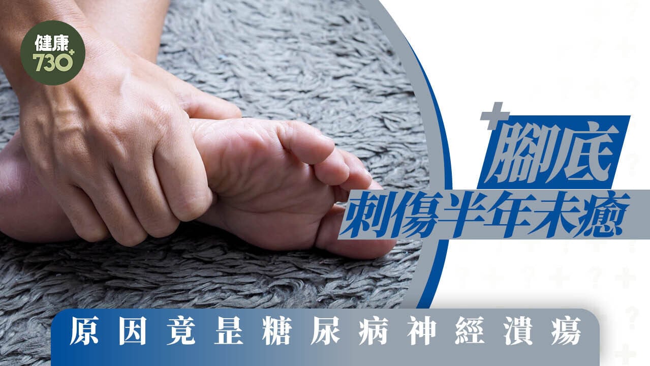 腳底刺傷半年未癒 原因竟昰糖尿病神經潰瘍