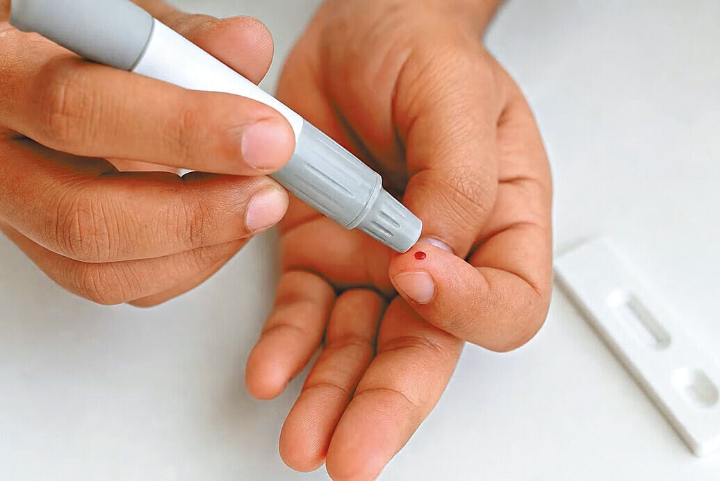 丙肝篩查只須「篤手指」便可完成,約20分鐘有結果。