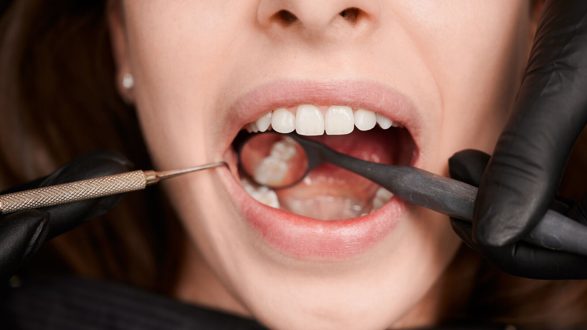 Macro photography beautiful female smile with white healthy teeth