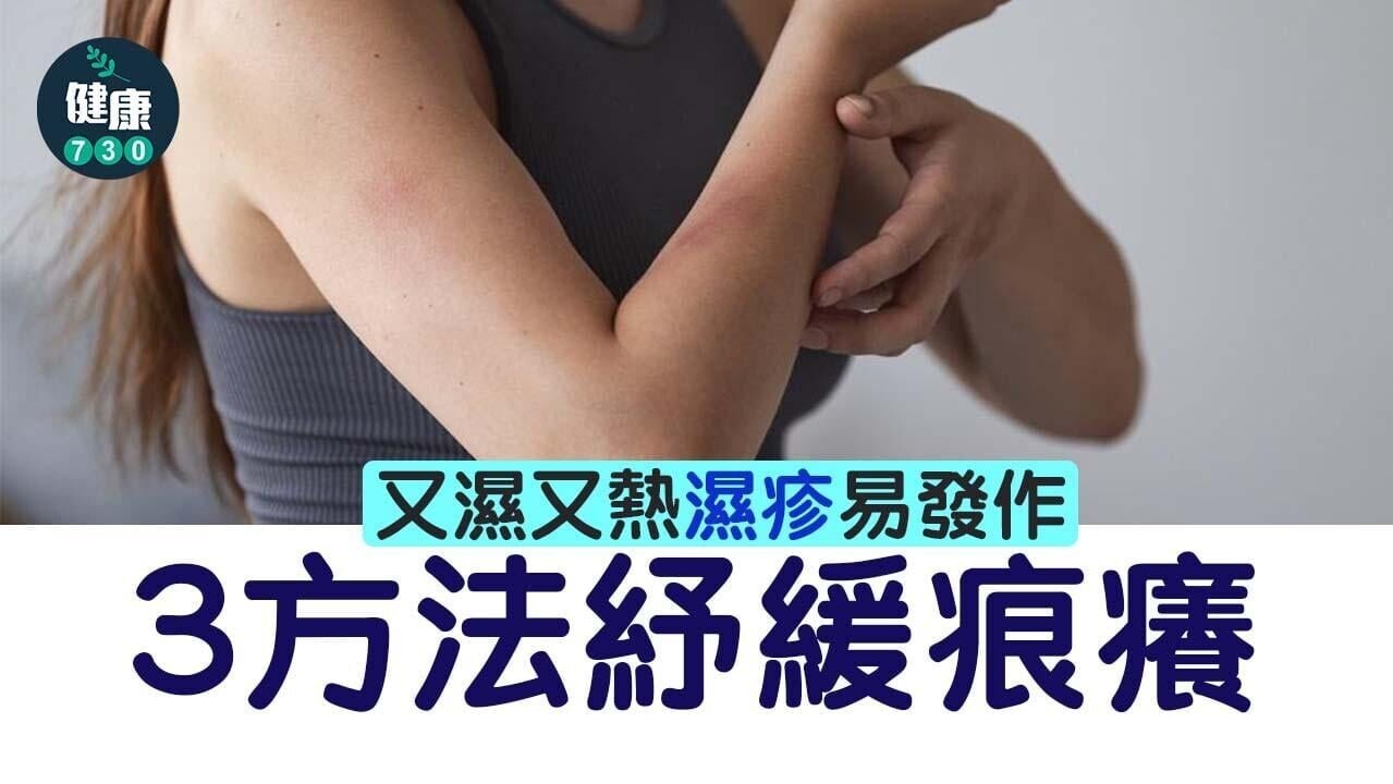 濕疹止痕方法｜又濕又熱易發作 3方法紓緩痕癢