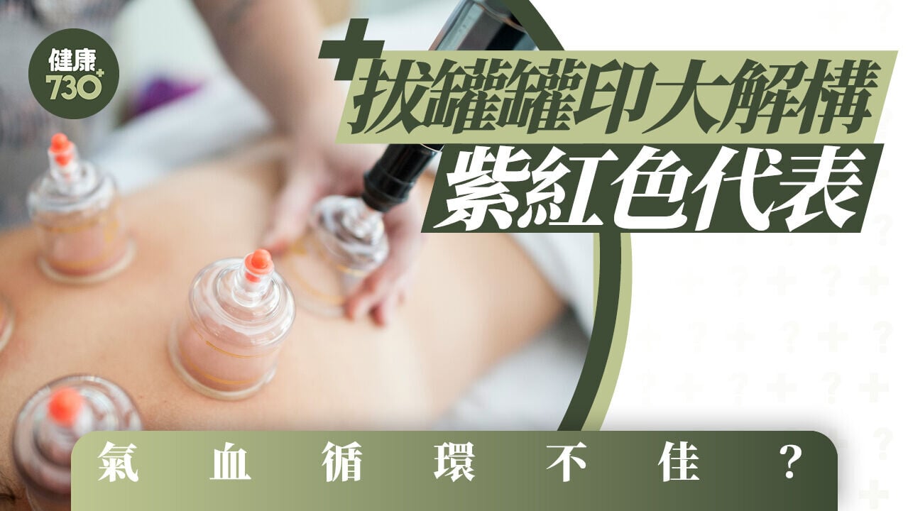 拔罐｜拔罐罐印大解構 紫紅色代表氣血循環不佳？
