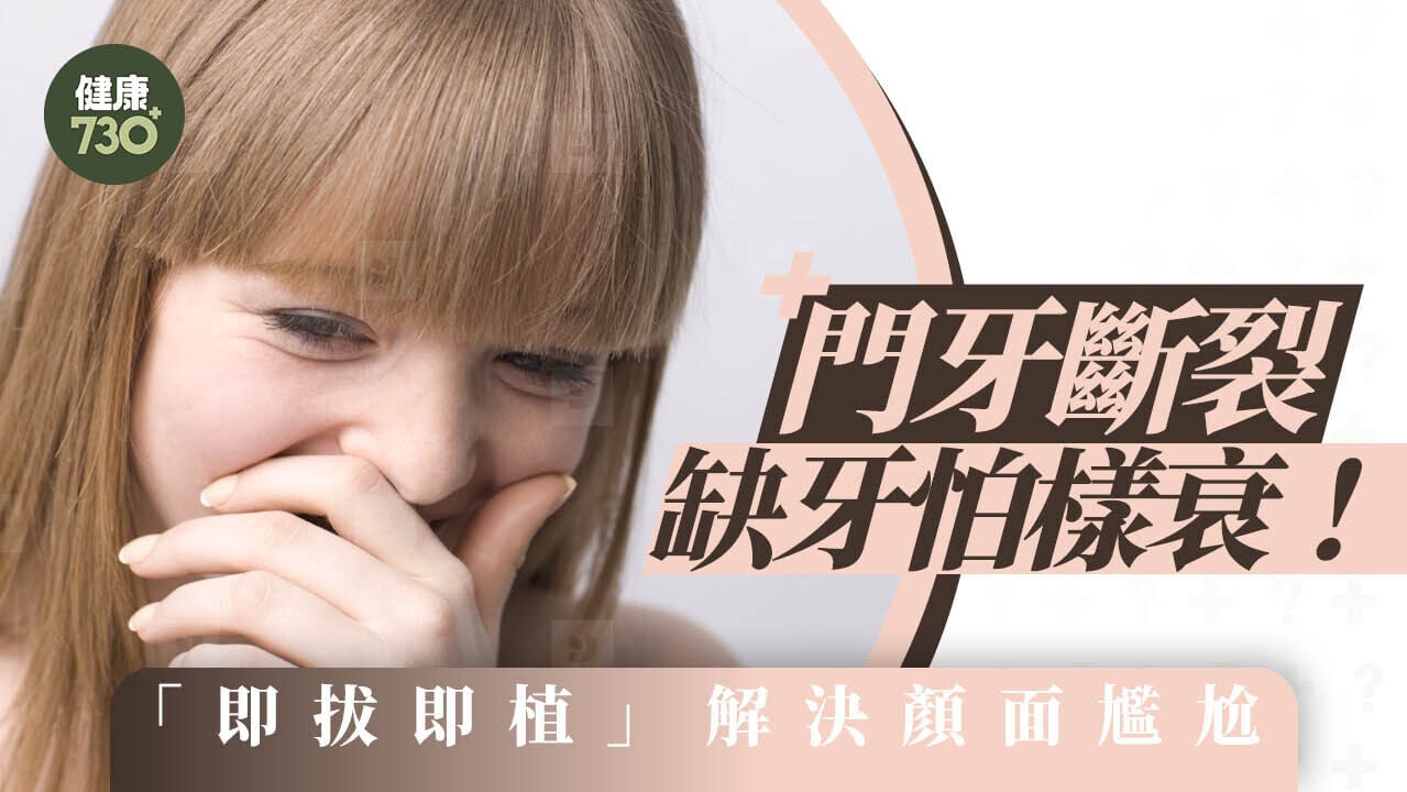 門牙斷裂缺牙怕樣衰！「即拔即植」解決顏面尷尬