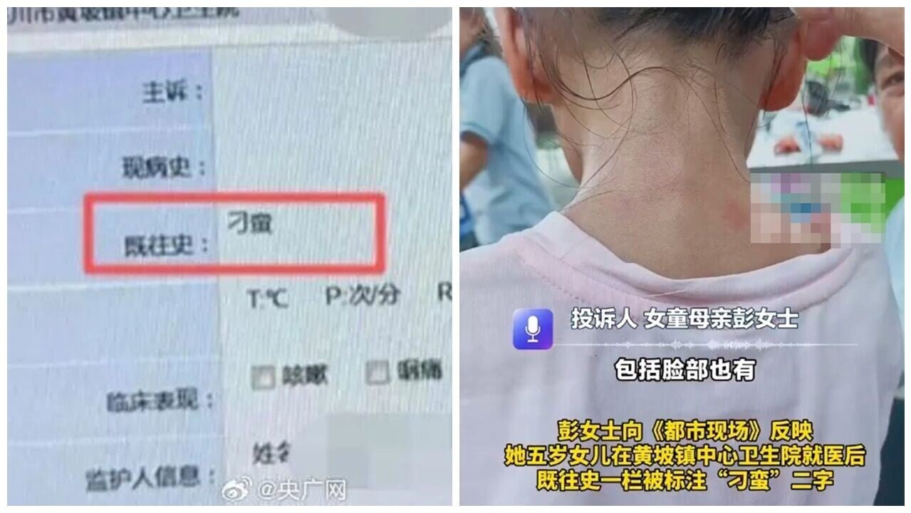 5歲女童電子病歷註「刁蠻」，原來醫生不想再看她。(微博)
