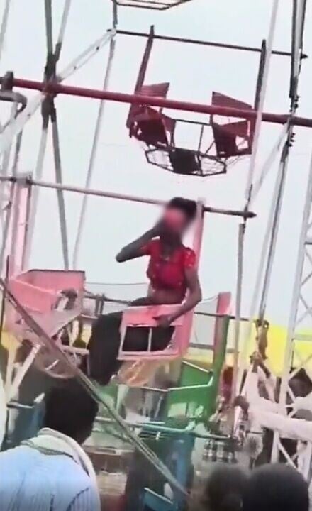 女子的頭髮被猛烈一扯,硬生生將她的頭皮從頭部撕開。(X)