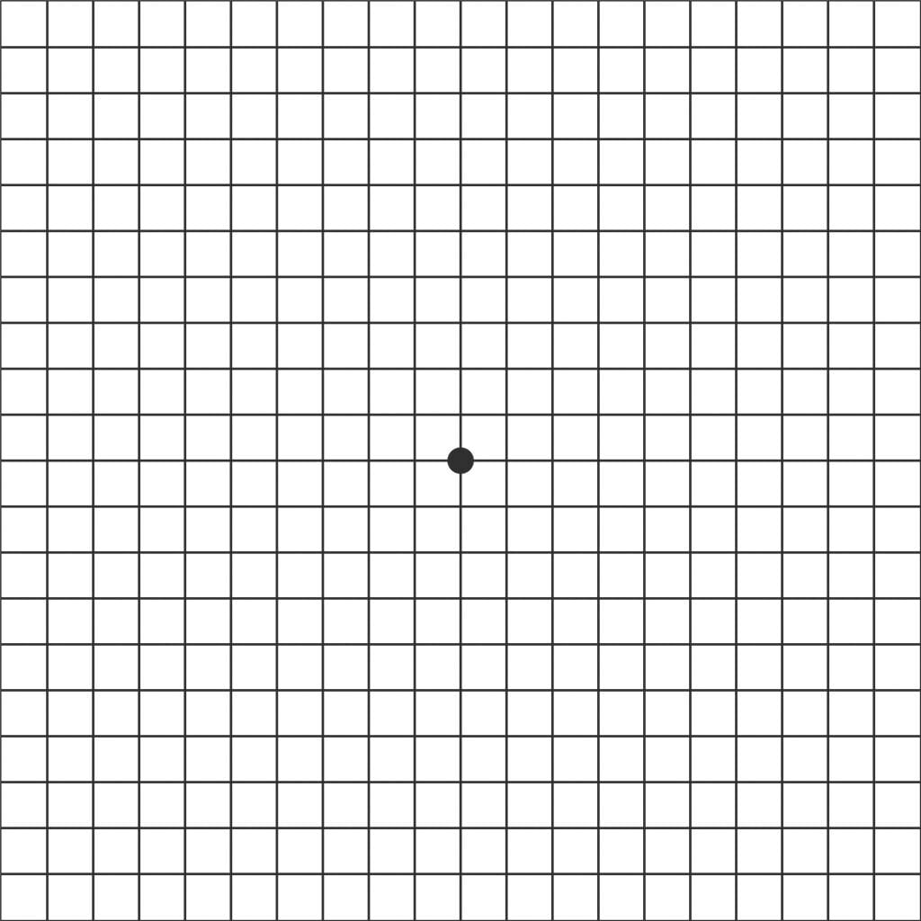 阿姆斯勒方格表