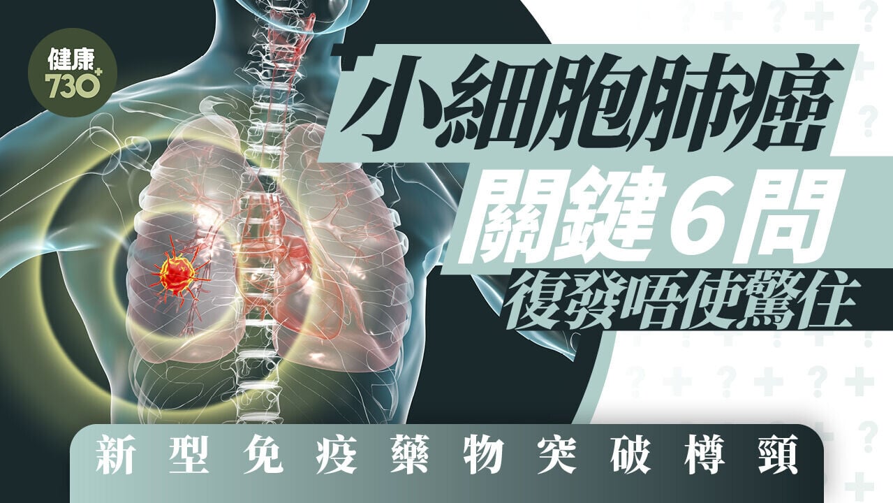 小細胞肺癌是癌王中的癌王，所幸今日已有新型免疫藥物可運用，為第二線治療帶來曙光，復發患者仍有望延長有品質的生命。