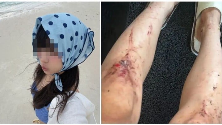 女事主獨遊馬來西亞度假村險遭性侵。事發時約凌晨3時許，當時天氣雷雨交加，她躲在叢林中，一直等到早上8時，期間被螞蟻蚊蟲不斷咬皮膚和傷口。（抖音@土包子(在韓版)）