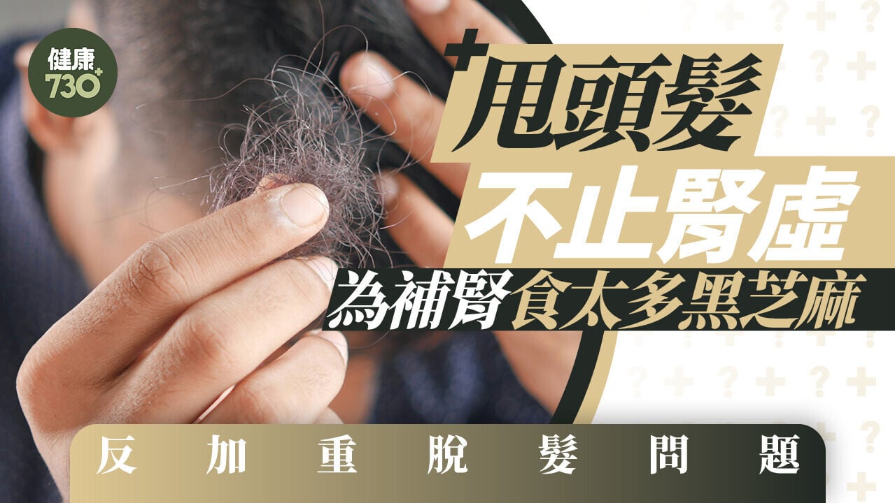 脫髮治療｜甩頭髮不止腎虛 為補腎食太多黑芝麻反加重脫髮問題