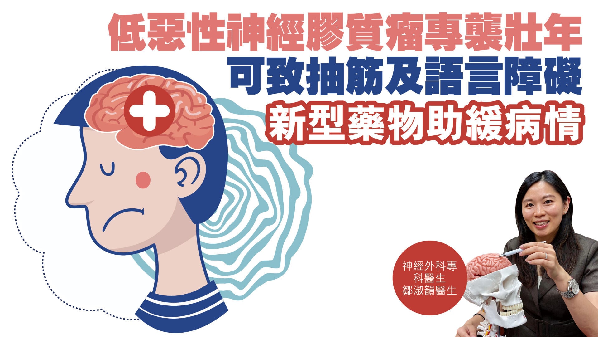 健康解碼｜低惡性神經膠質瘤專襲壯年 可致抽筋及語言障礙 新型藥物助緩病情