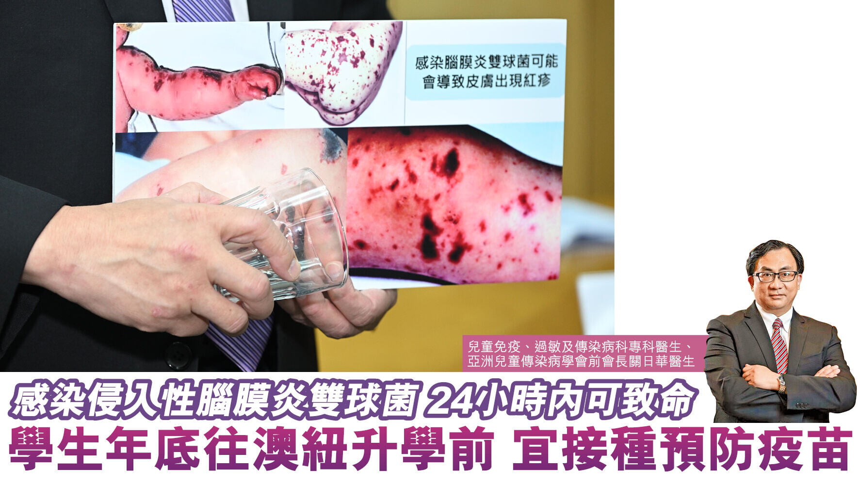 健康解碼｜感染侵入性腦膜炎雙球菌 24小時內可致命 學生年底往澳紐升學前 宜接種預防疫苗