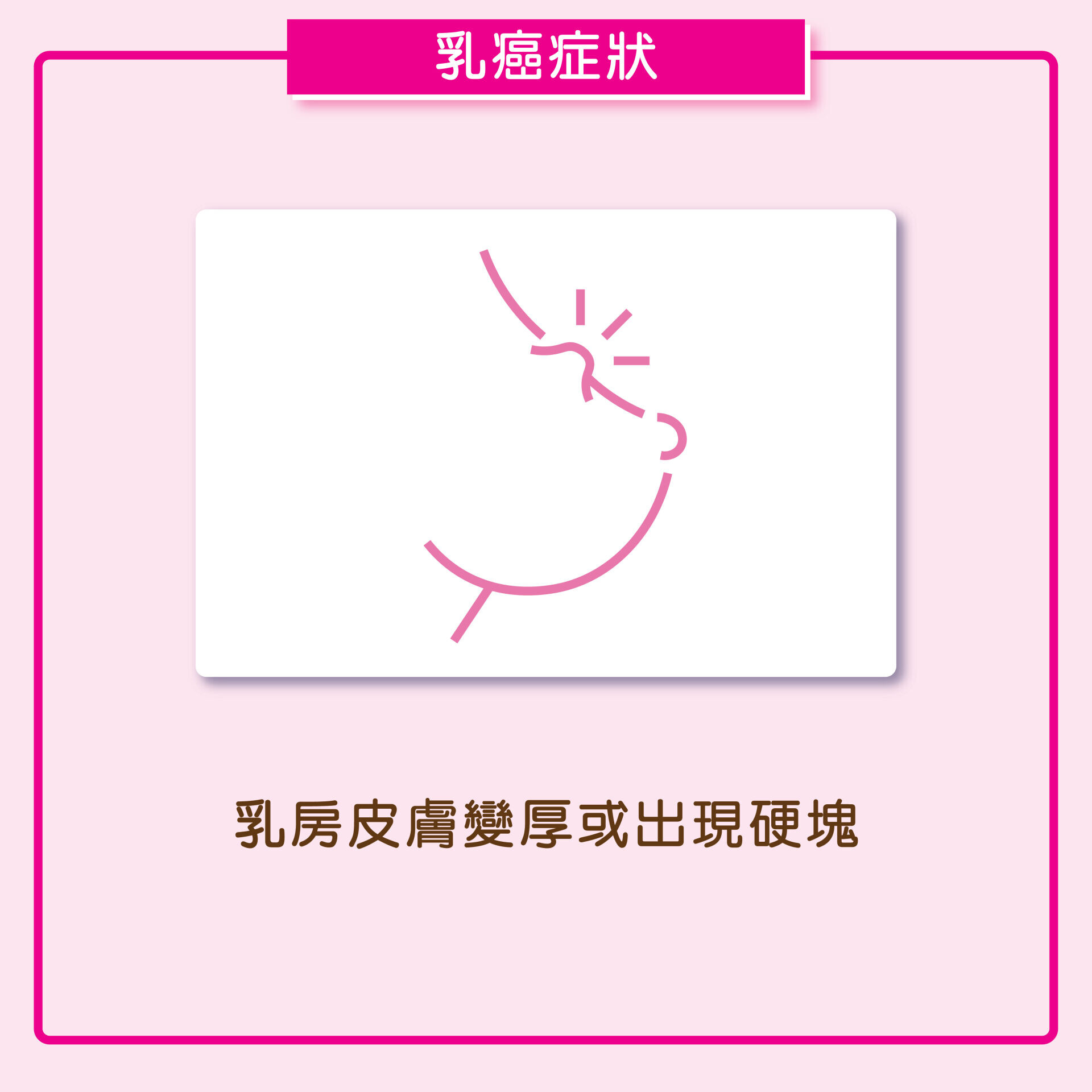 AM730 Breast Cancer Symptoms 01
