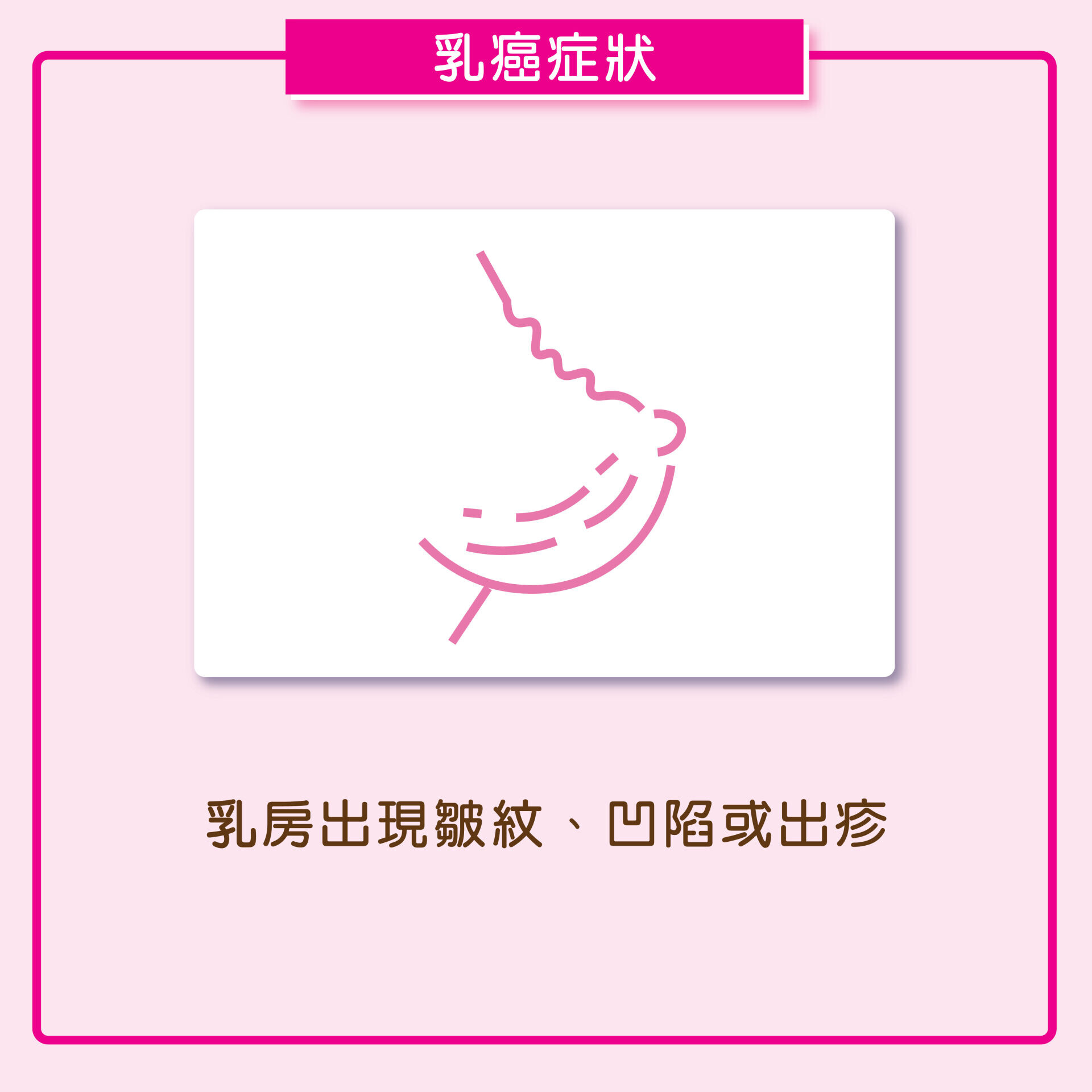 AM730 Breast Cancer Symptoms 02
