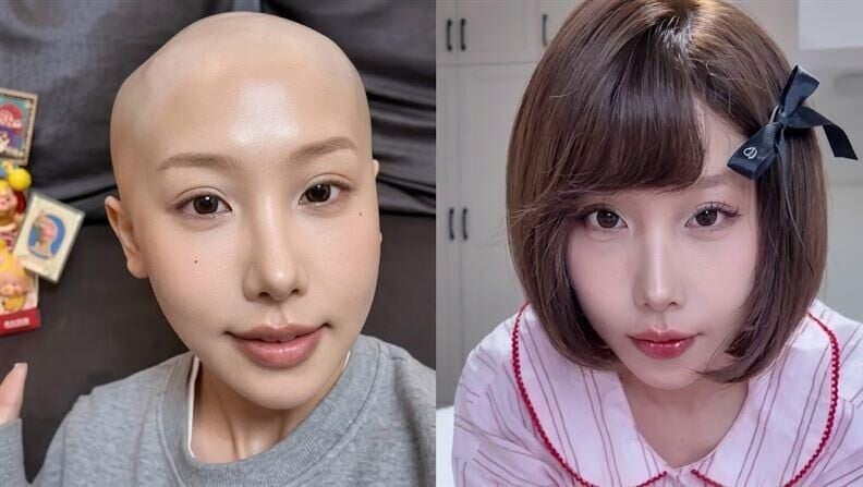 「嘻嘻徐寶」胃癌過世，得年25歲。（圖／翻攝嘻嘻徐寶的抖音）
