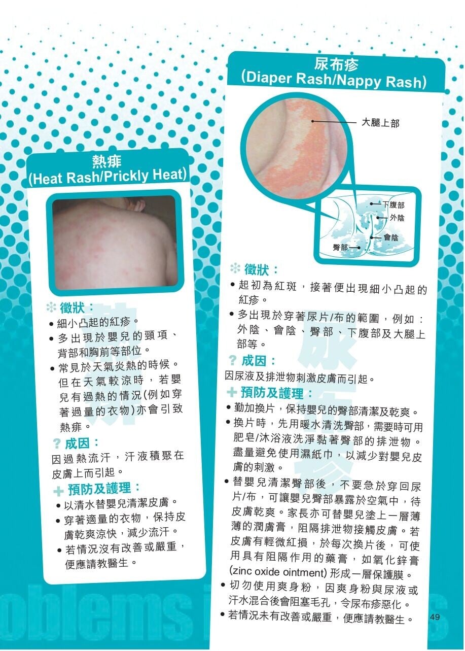 常見嬰兒皮膚問題,包括熱痱、尿布疹(衛生署)