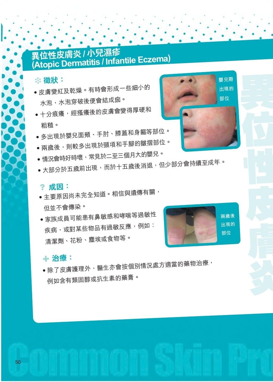 常見嬰兒皮膚問題,包括小兒濕疹(衛生署)