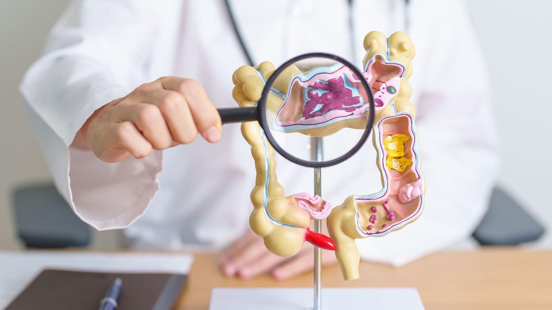 盡快參加大腸癌篩查計劃 及早識別 守護健康