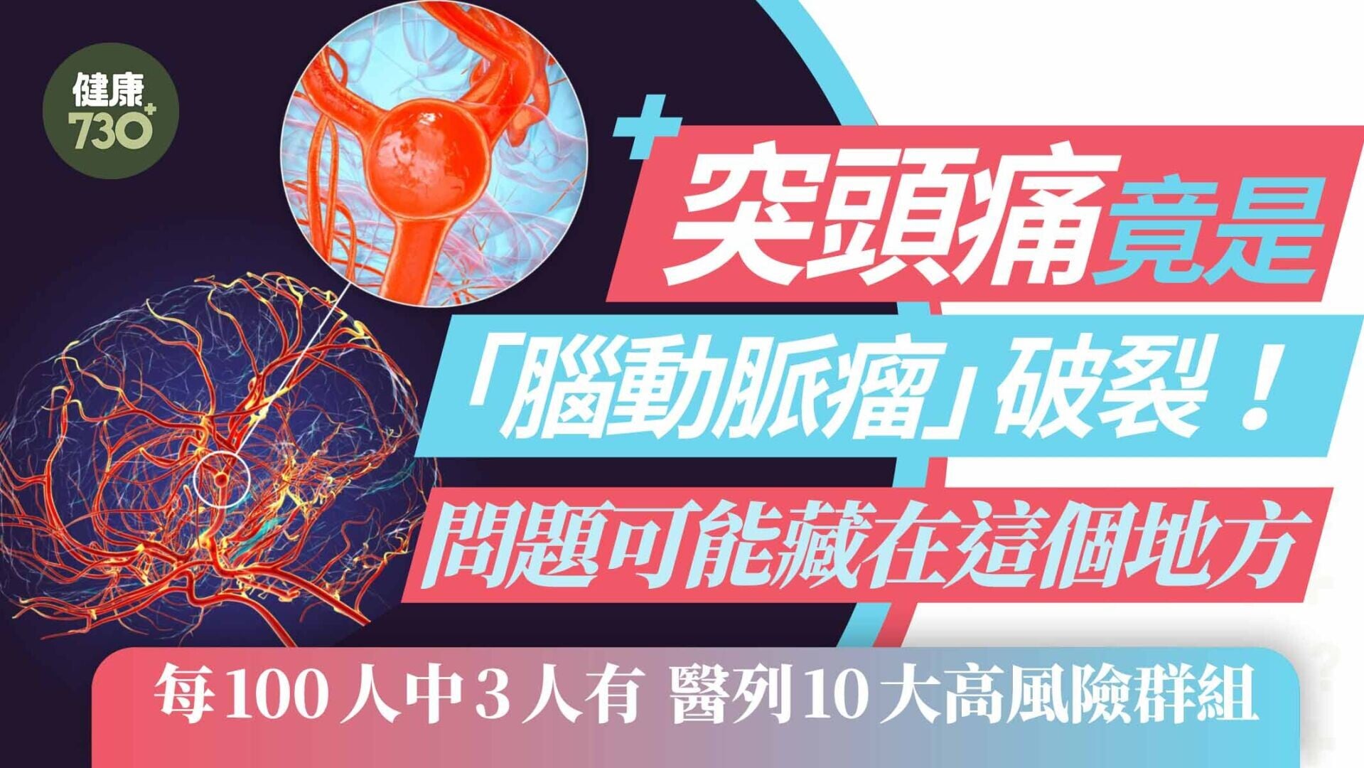 突頭痛竟是「腦動脈瘤」破裂！每100人中3人有 醫生列出10大高風險群組