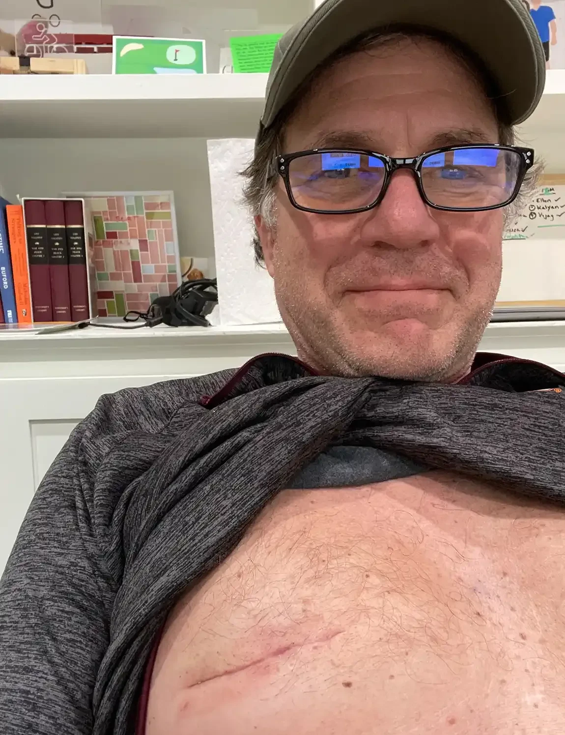 62歲男子Robert Pfleghardt選擇接受局部腫瘤切除
