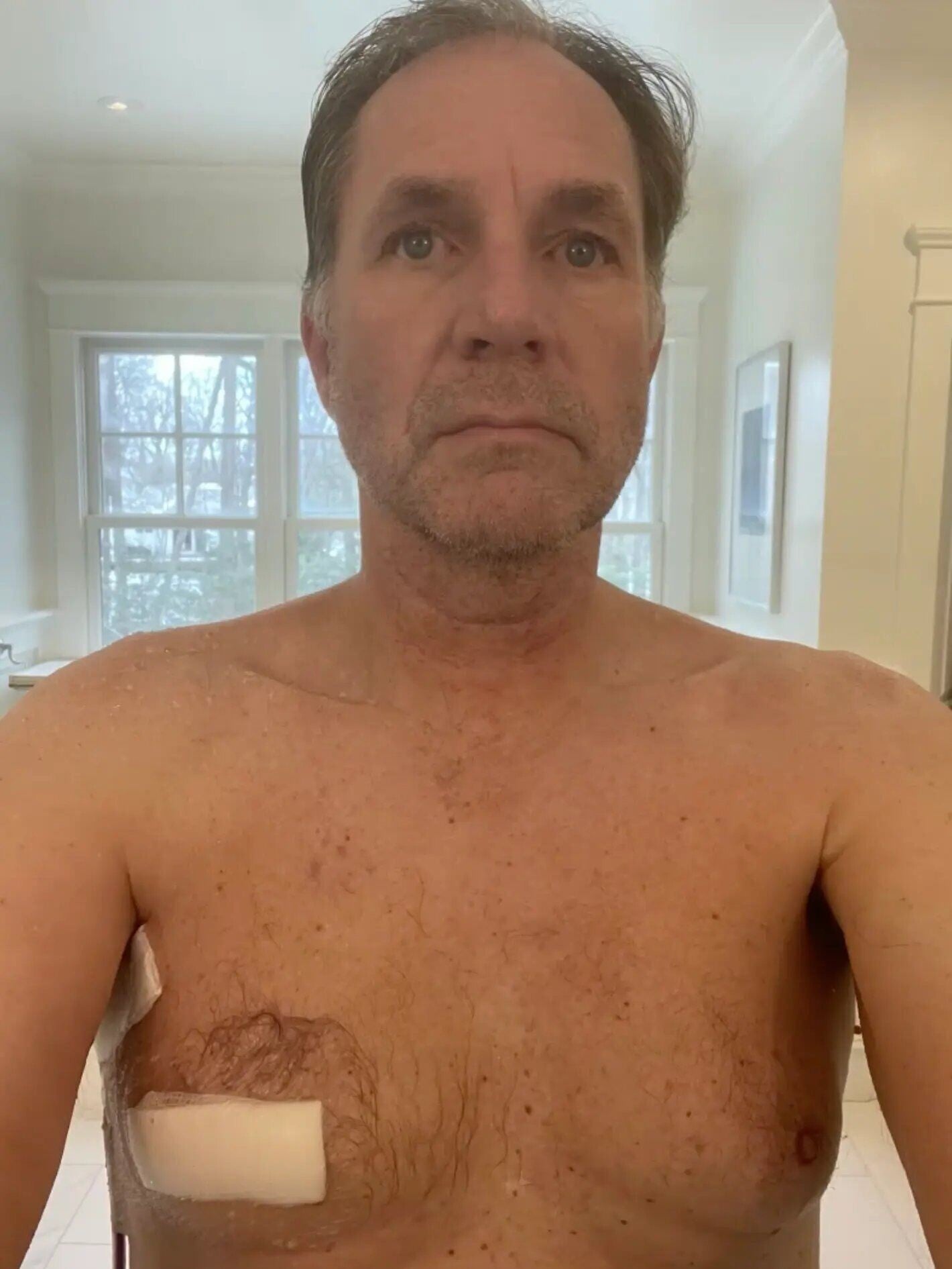 62歲男子Robert Pfleghardt手術後,腫瘤邊緣相當清楚