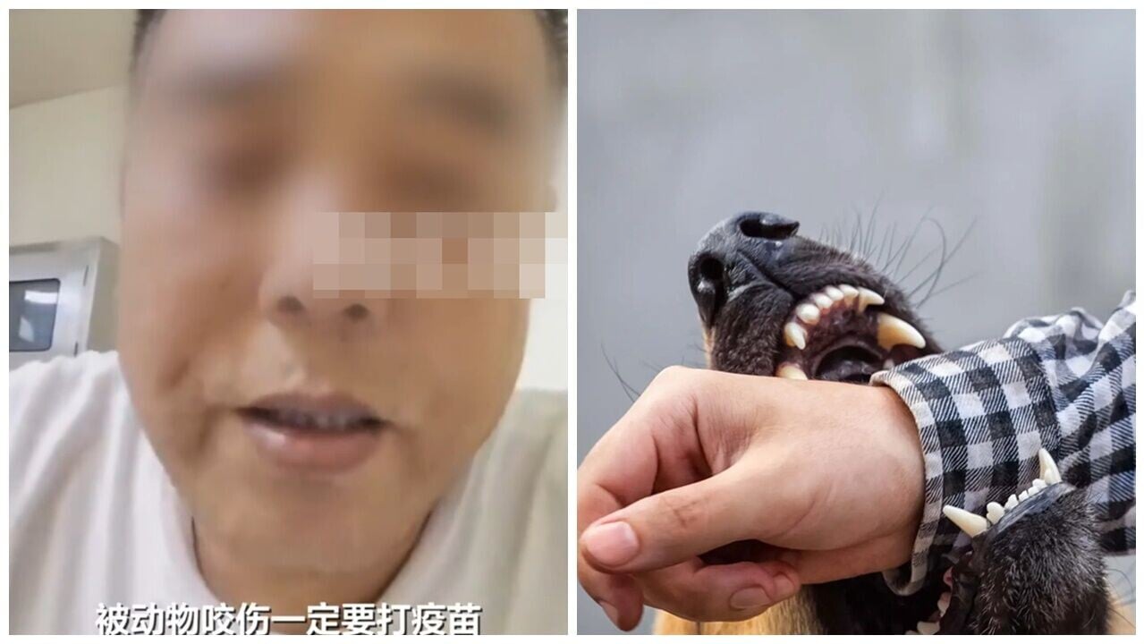 湖南漢被狗咬不打疫苗一個月後亡，死前拍片後悔：為慳兩千蚊送命。(微博)