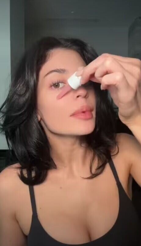 Kylie Jenner是玻璃肌推手之一