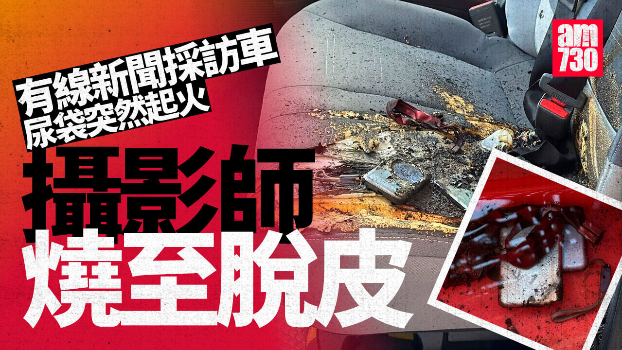 長沙灣有線新聞採訪車「尿袋」起火　27歲攝影師多處燒傷
