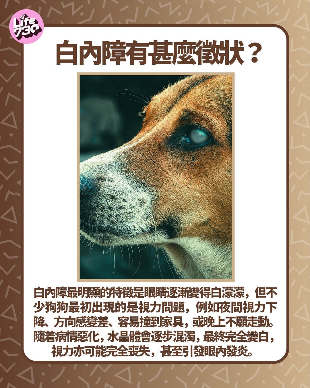 白內障有甚麼徵狀?