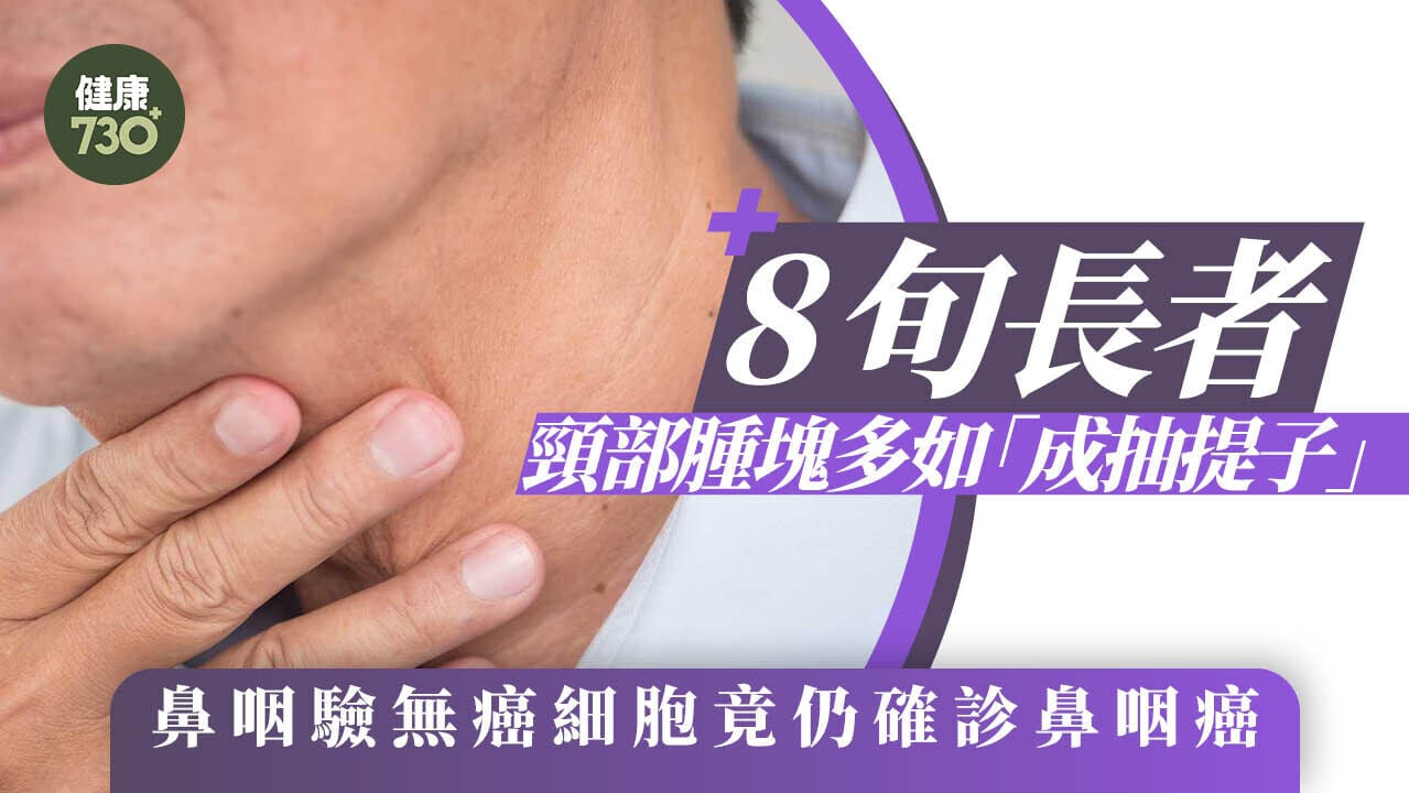 8旬長者頸部腫塊多如「成抽提子」　鼻咽驗無癌細胞竟仍確診鼻咽癌