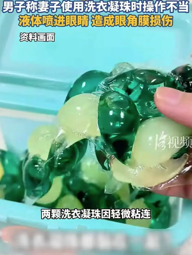 女子撕開洗衣珠 液體濺射入眼腐蝕眼角膜