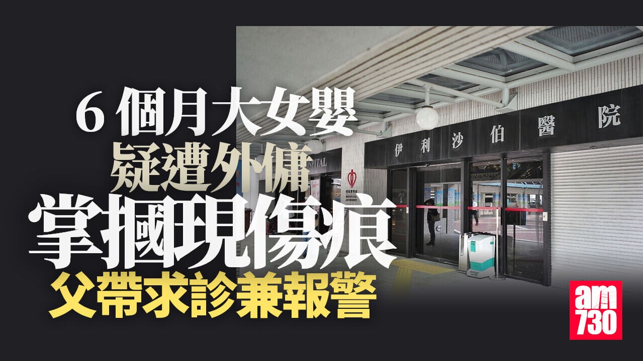 Mc 17